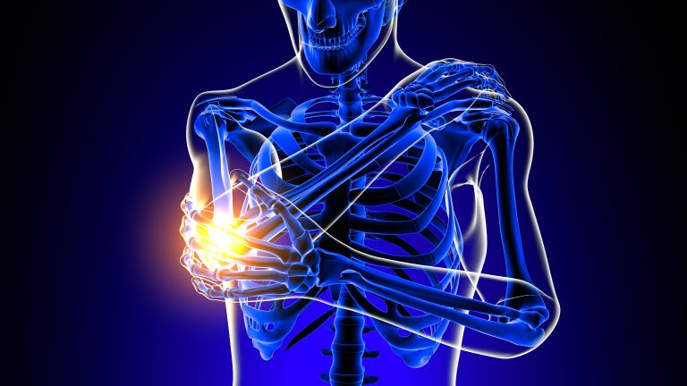 PTCB Guide to NSAIDs